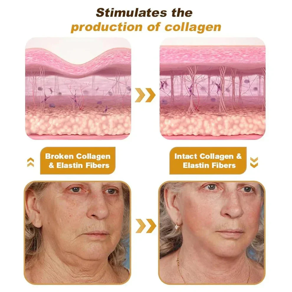 Botox Bee Venom Wrinkle Remover Cream (Buy 1 Get 1 Free)