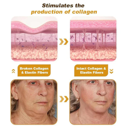 Botox Bee Venom Wrinkle Remover Cream (Buy 1 Get 1 Free)